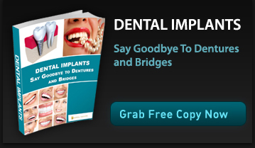 dental-implants