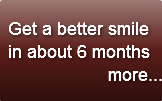  Get a better smile in about 6 months   