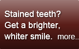   Stained teeth?   Get a brighter,  whit