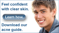 acne-guide-to-feel-confident