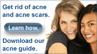 acne-guide-get-rid-of-acne-scarring