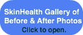 skinhealth-gallery-of-before-amp-after