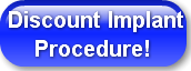 discount-implant-procedure